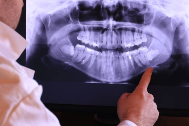 Best Emergency Gum Treatment in Reidsville, NC